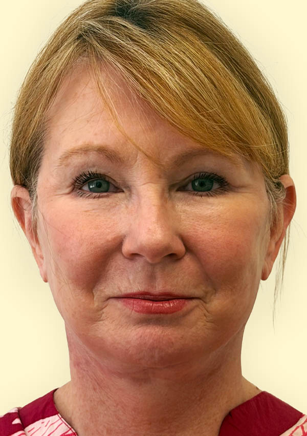 1_0000_RA AP Post.png